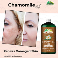 Chamomile Oil – Give Healthy Look to Your Face & Hair With This Majestic Liquid [بابونہ] - Mamasjan