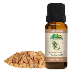 Frankincense Essential Oil – Best for Removing Dark Circles - Mamasjan