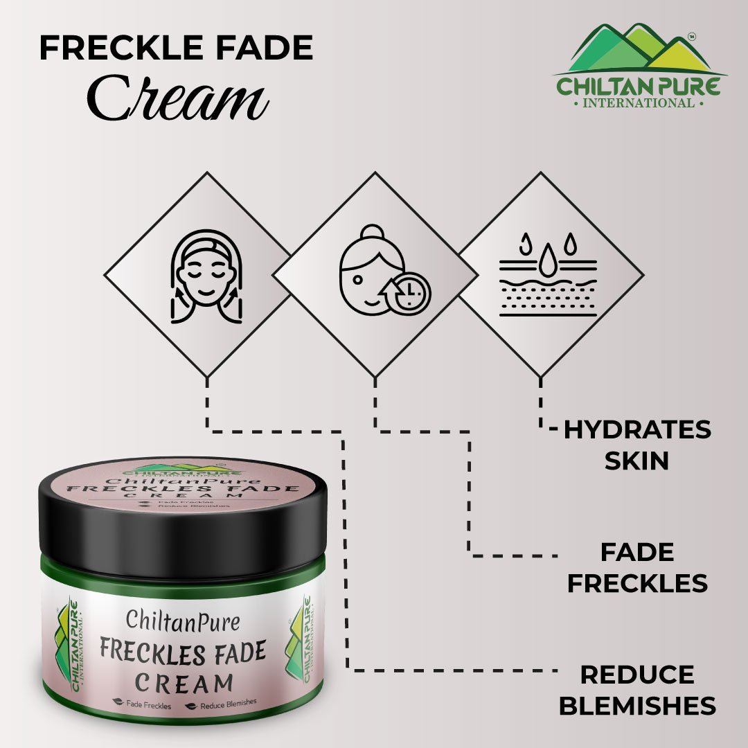 Freckles Fade Cream – Hydrates Skin, Fade Freckles, Reduce Blemishes & Lightens Hyperpigmentation