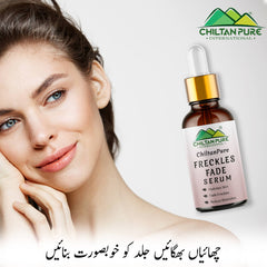 Freckles Fade Serum – Hydrates Skin, Fade Freckles, Reduce Blemishes & Lighten Pigmentation - Mamasjan