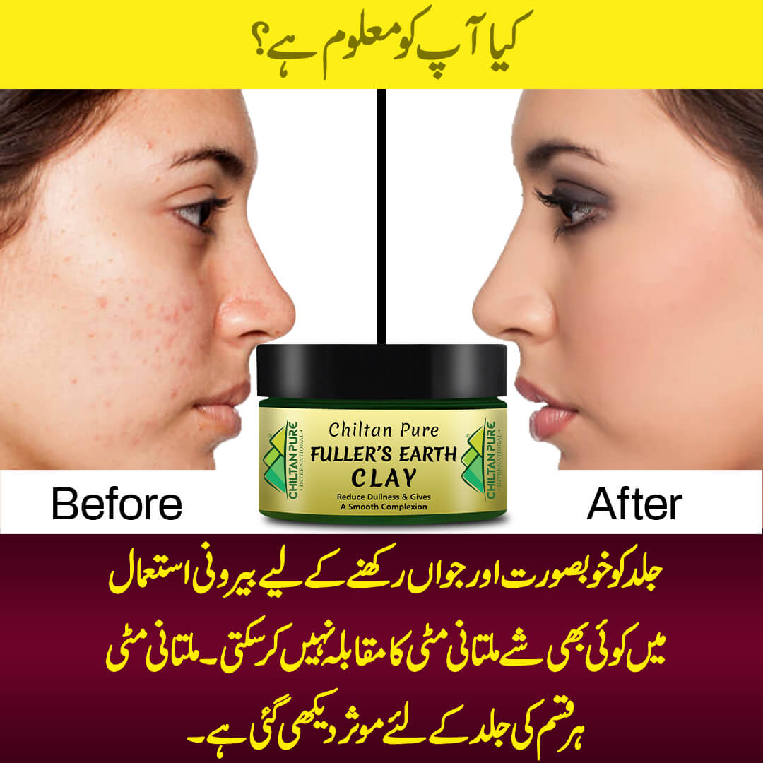 Fuller's Earth Clay - Acne Fighter Clay [Multani Mitti][For Oily Skin] - Mamasjan