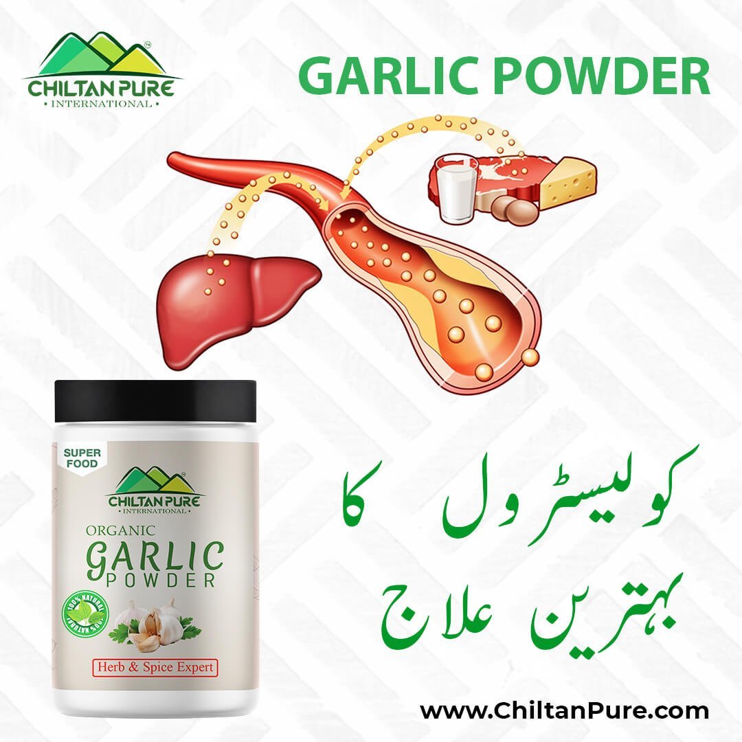 Garlic Powder – With Powerful Cholesterol Lowering Ability & Combat Obesity [لہسن] - Mamasjan