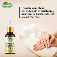 Nails & Cuticle Oil – Moisturizes & Strengthen Nails & Cuticle, Rejuvenates Dry, Damaged & Inflamed Nails, Protects Against Infections - Mamasjan