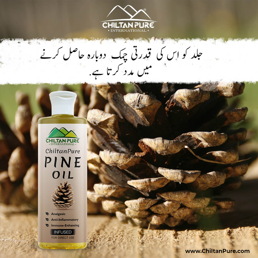 Pine Infused Oil – Decongestant, Circulation-Stimulating & Immune-Enhancing - Mamasjan