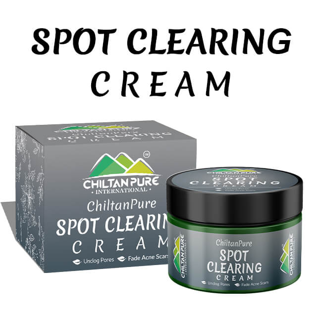 Spot Clearing Cream - Unclogs Pores, Fades Stubborn Dark Spots & Lightens Acne Scars, - Mamasjan