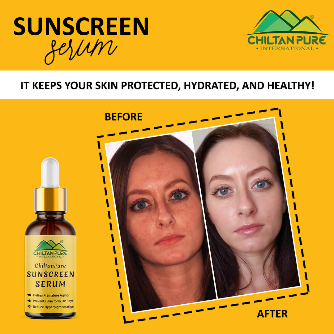 Sunscreen Serum – Delays Premature Aging, Prevents Skin from UV Rays, Reduce Hyperpigmentation & Risk of Skin Cancer 30ml - Mamasjan