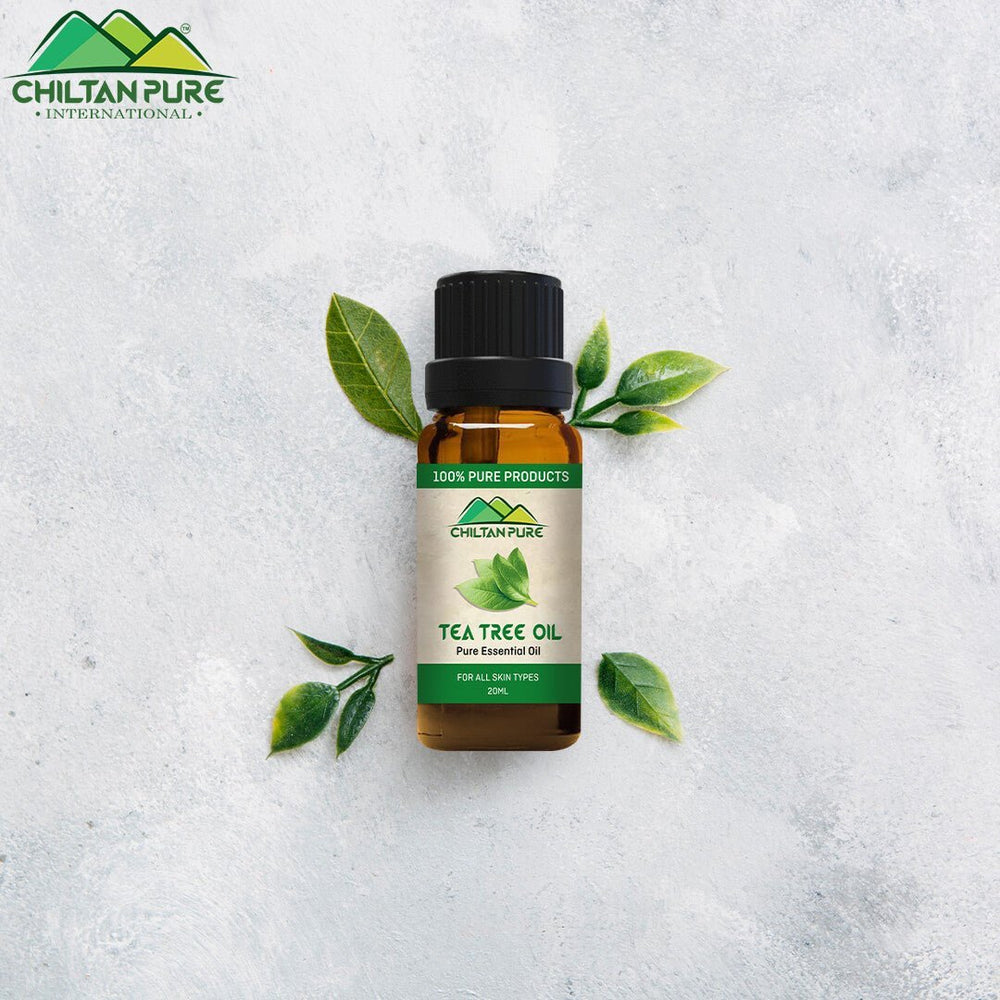 Tea Tree Oil – Best for Acne Treatment - Mamasjan