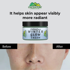Winter Glow Cream – Formulated With Multivitamins & Moisturizers, Makes Skin Soft & Supple, Good For Dry & Dehydrated Skin - Mamasjan