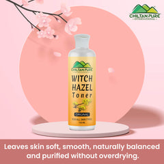 Witch Hazel Toner (Original) – Pore Perfecting Toner, Reduces Inflammation, Soothes Skin & Fights Acne - Mamasjan