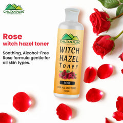 Witch Hazel Toner with Rose – Helps in Shrink Pores, Soothe Puffy Eyes & Improves Skin Tone, For All Skin Types - Mamasjan